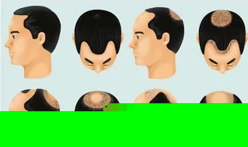 123
