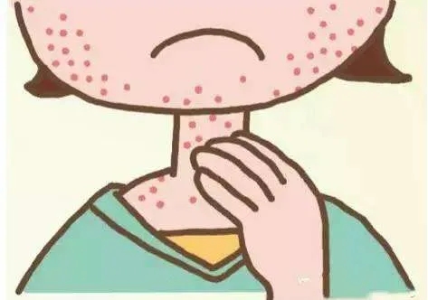 123